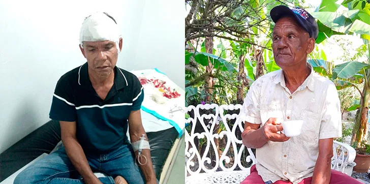 Coronel retirado mata a su hermano en medio de disputa familiar en SFM