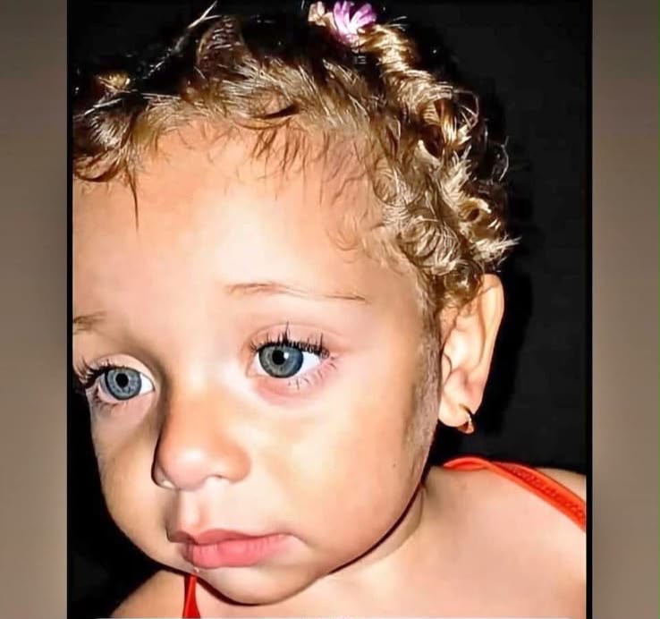 Fallece niña de un año y aumenta a dos el número de víctimas por explosión de tanque de gas en fritura de SFM